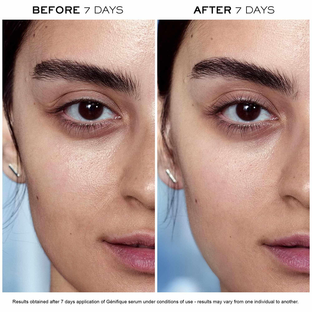 Lancôme Advanced Génifique bottle emphasizes 10% Bifidus Prebiotic for skin microbiome.