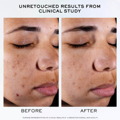 Lancôme Clarifique Pro-Solution ingredients highlight ten-percent PHA and niacinamide.