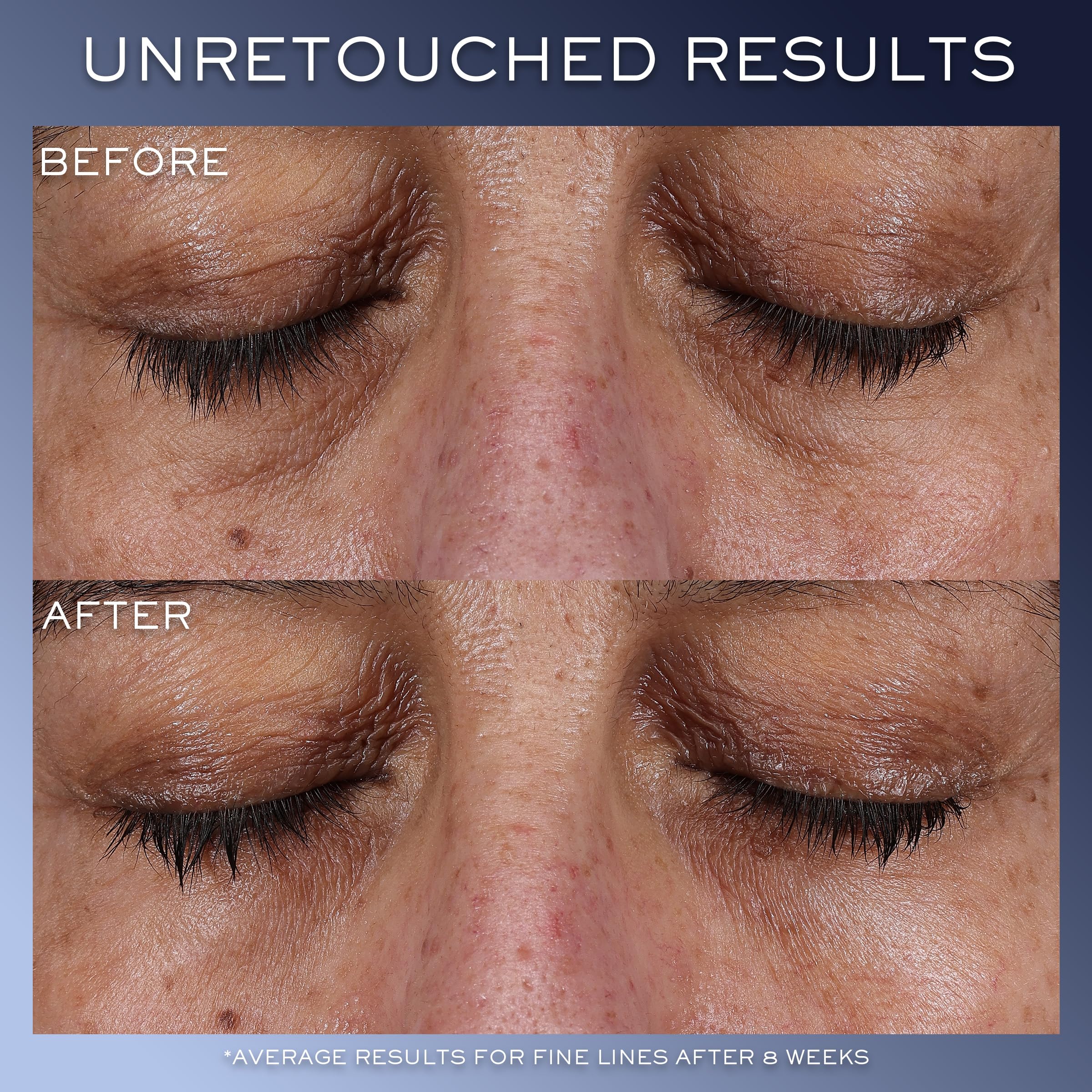Lancôme Génifique Eye Cream cap close-up highlights precise application control