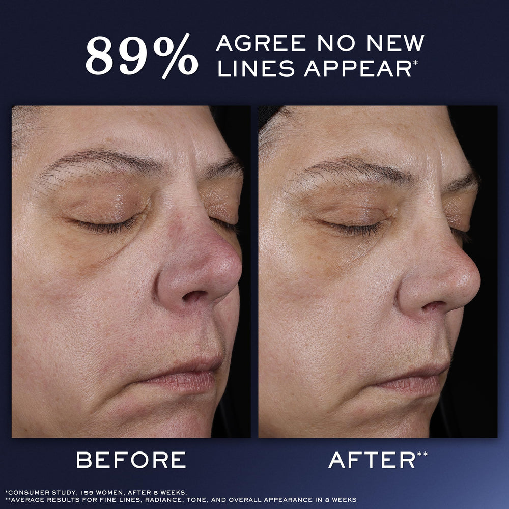 Lancôme Génifique Ultimate Recovery refill pack ready for sustainable skincare