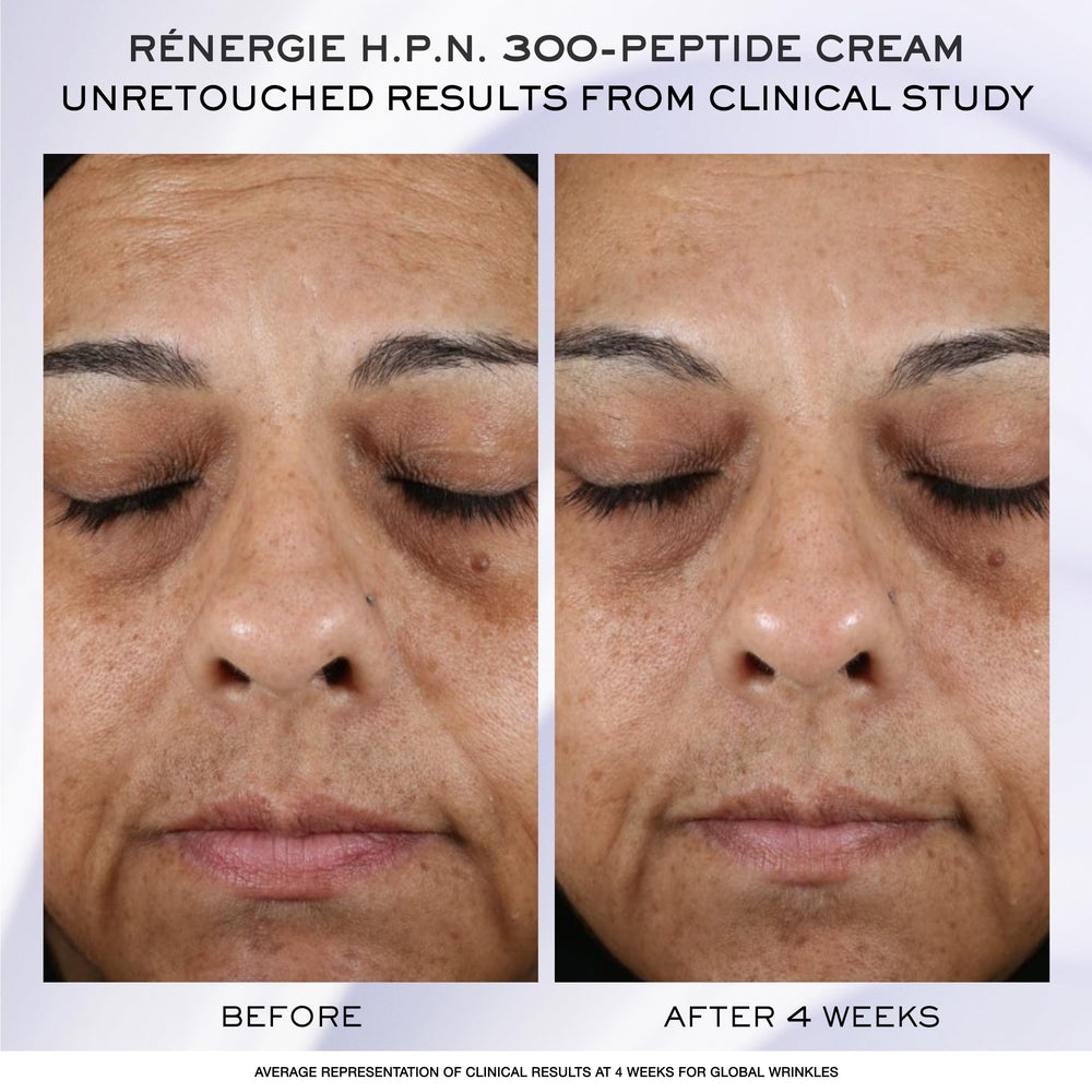 Lancôme Rénergie H.C.F. serum texture close-up shows silky finish.