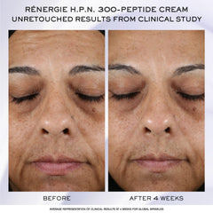 Lancôme Rénergie H.C.F. serum texture close-up shows silky finish.