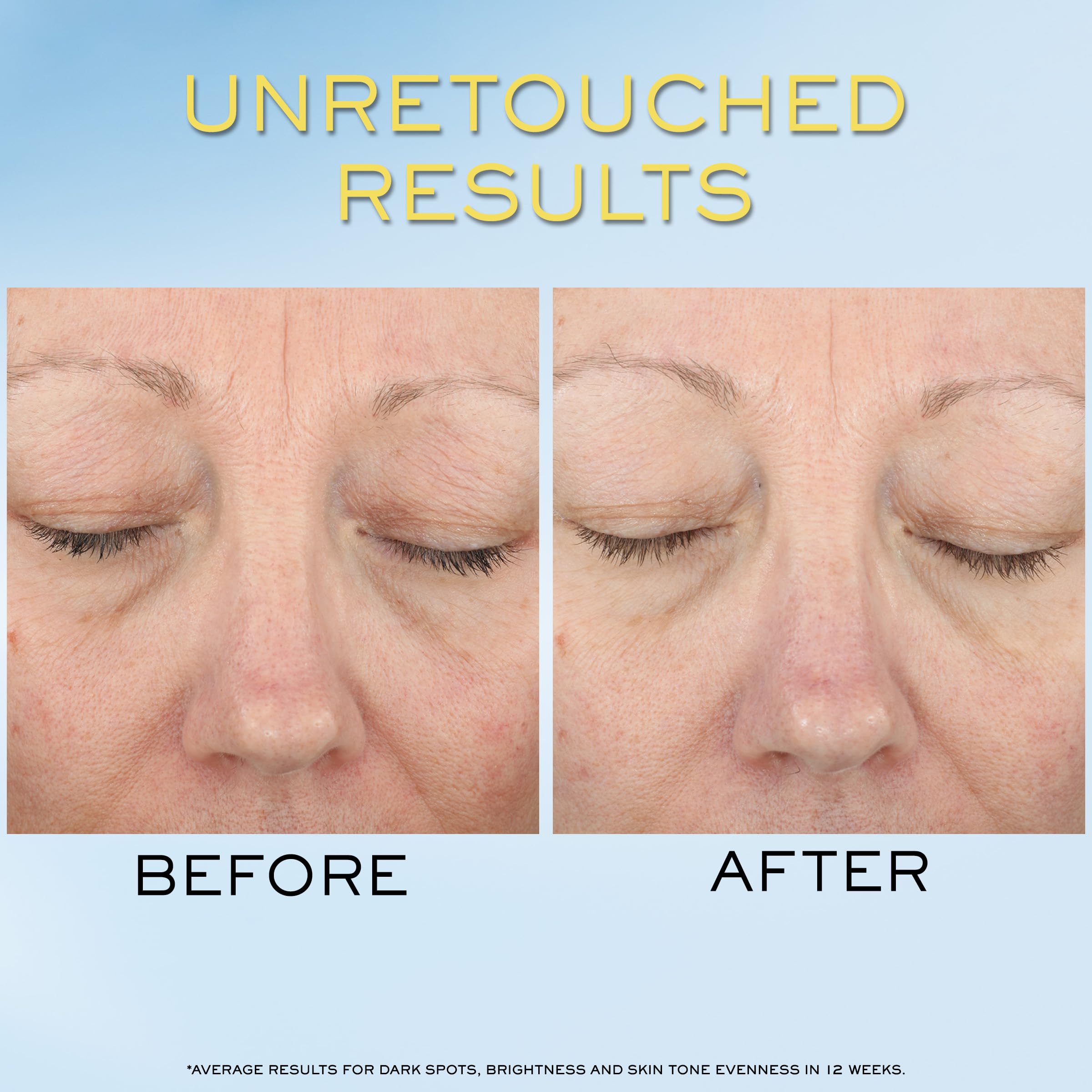 Lancôme Supra Screen application closeup showing invisible serum texture on skin.