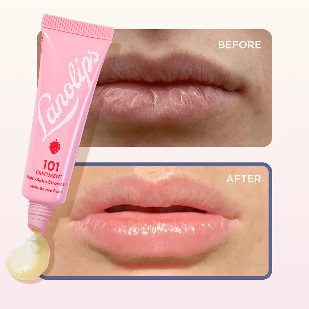 Lanolips 101 Ointment serves as a multipurpose lip and skin balm daily.