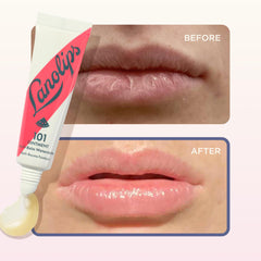 Lanolips 101 Ointment Watermelon dry patches visibly softened.