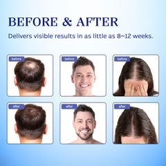 Lavtek bottle shows biotin and castor oil-infused formula for scalp nourishment