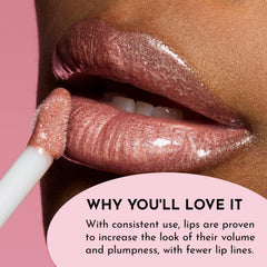 Lawless Forget the Filler Lip Gloss Candy Sky lips closeup shows glossy, hydrated appearance
