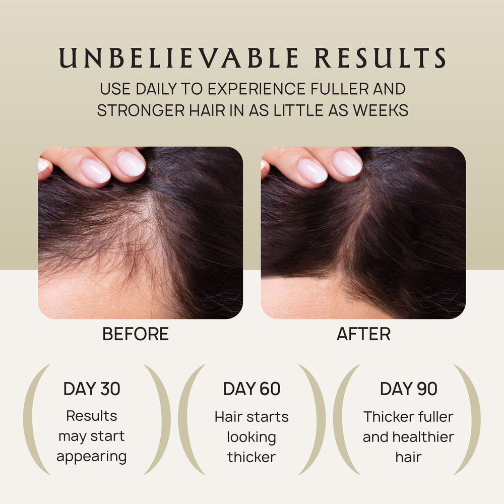 Lebanta Hair Growth Oil Spray on a bathroom shelf signaling easy daily use and non-greasy feel.