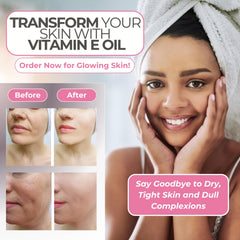 Leven Rose Vitamin E oil used in daily skin care routine.