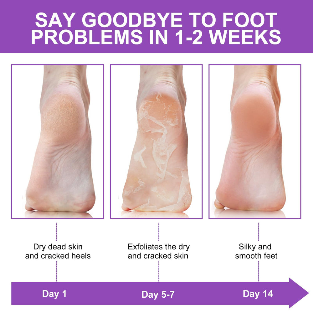 Heel care with Liefiet lavender mask to address dryness
