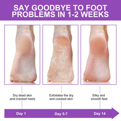 Heel care with Liefiet lavender mask to address dryness