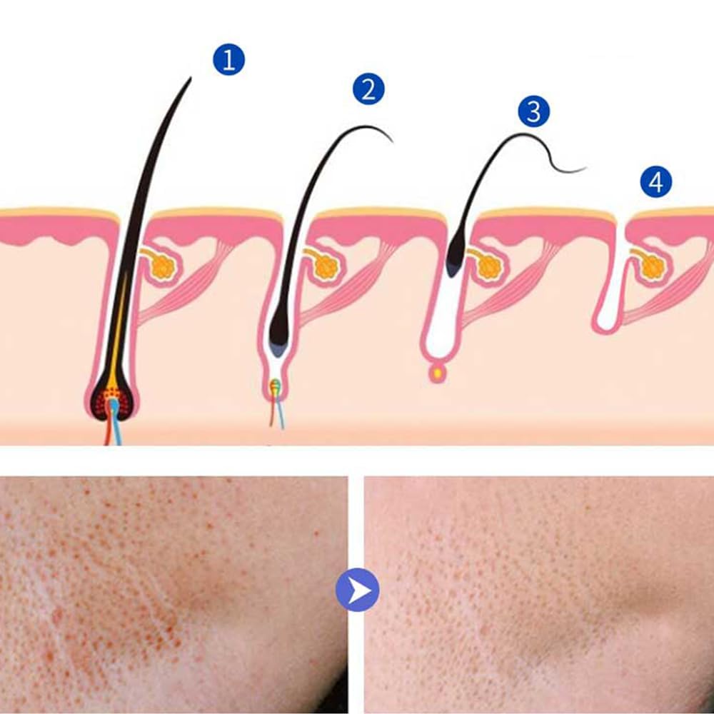 LINEDSON arm hair inhibitor cream on skin delivering moisturizing care