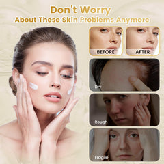 Lingmeier balm applied to hands and elbows for dry winter skin relief