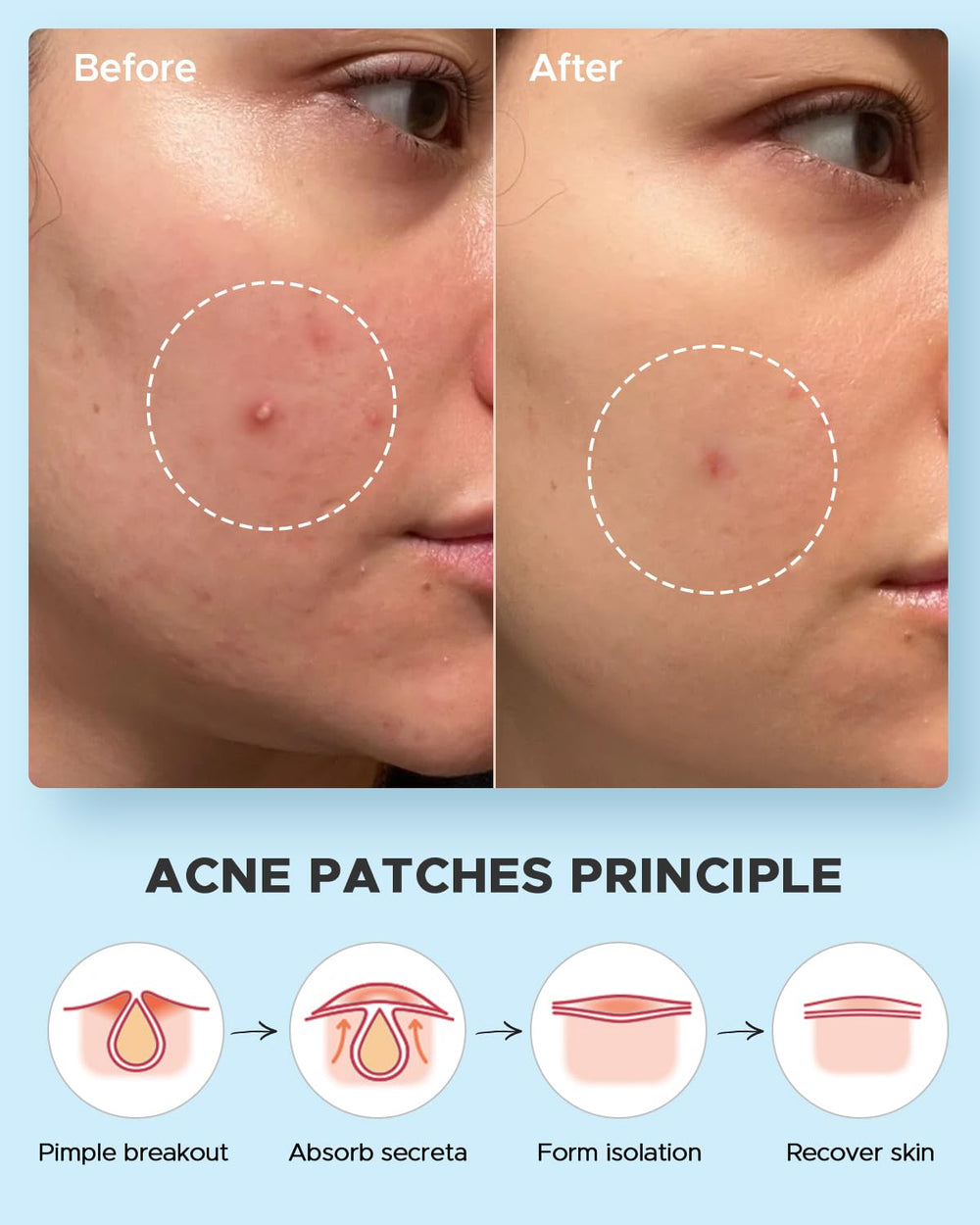 LitBear patch with witch hazel oil for overnight absorption.