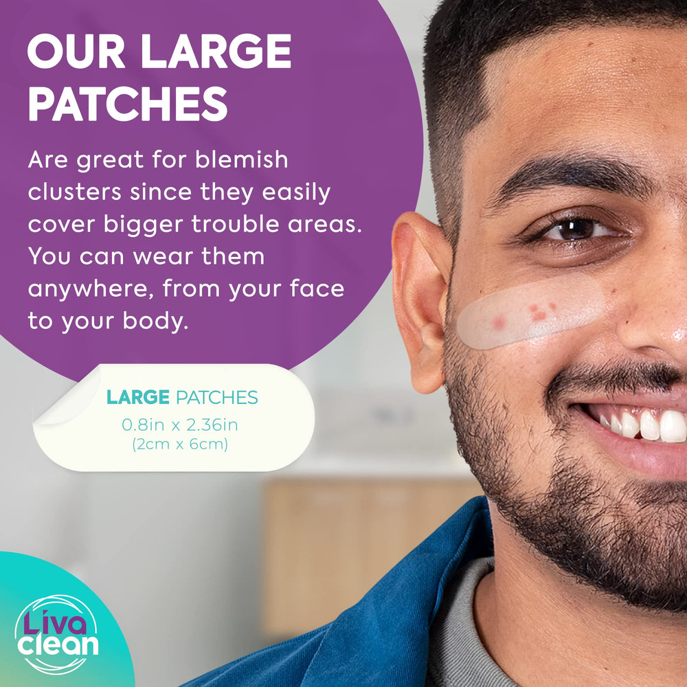 LivaClean patch applied to a zit close-up shows patch transparency.