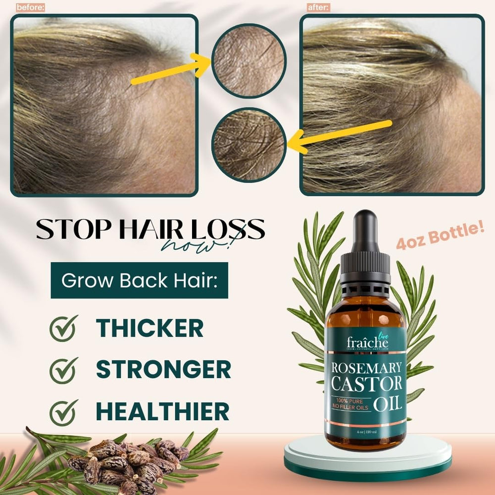Live Fraiche Rosemary Castor Oil dropper for precise scalp application