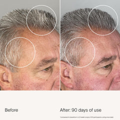 Living Proof Density Serum grey hair visibility reduction possibility on roots