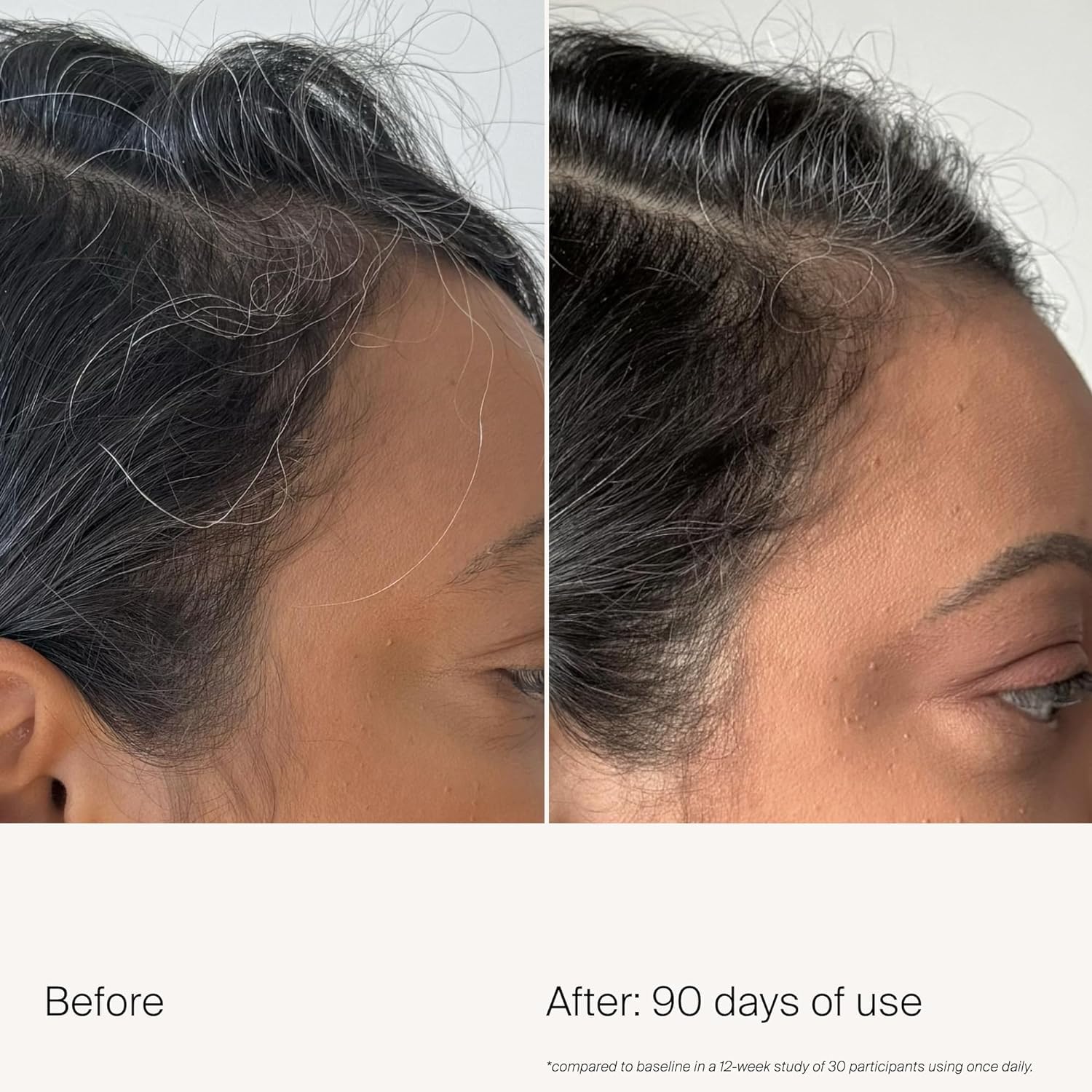 Living Proof Density Serum scalp application close-up