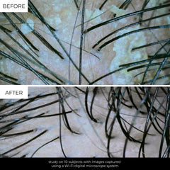 LolaVie AHAs close-up illustrating flakes dissolution.