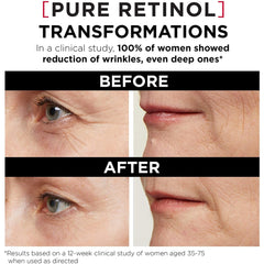 Application scene with L'Oreal Paris Revitalift LZR serum moisturizes skin