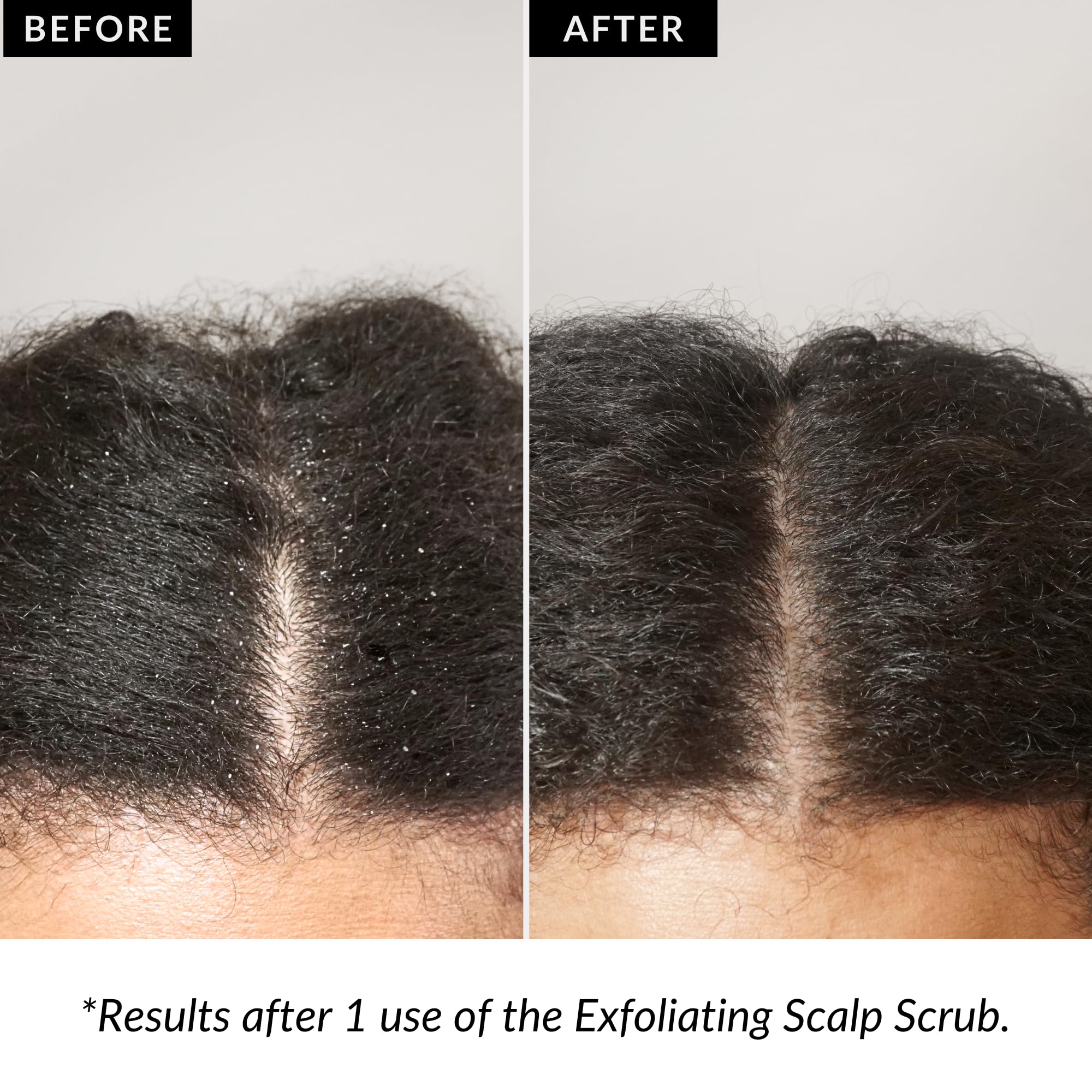 Love Ur Curls Exfoliating Scalp Scrub designed for pre-shampoo use with an applicator.