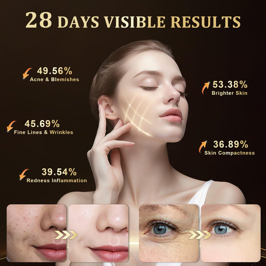Lovsheme blue light therapy targets acne-prone areas for clearer-looking skin