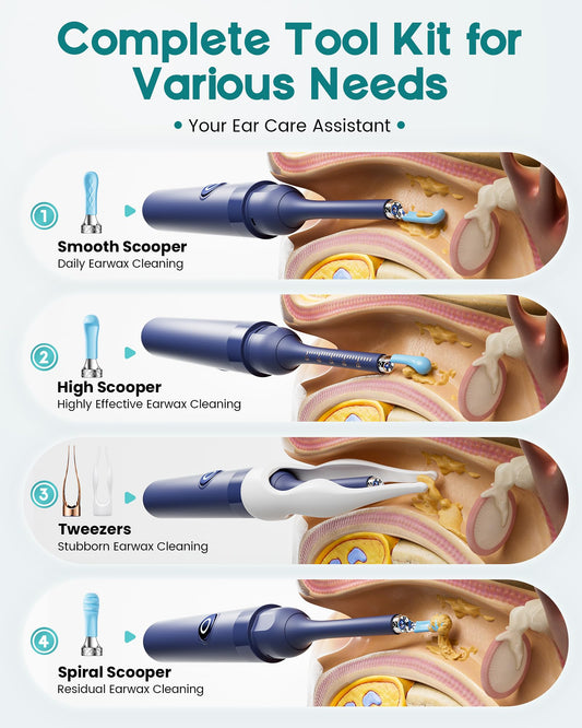Loyker 12 ear spoon tips enable versatile ear care for family use.