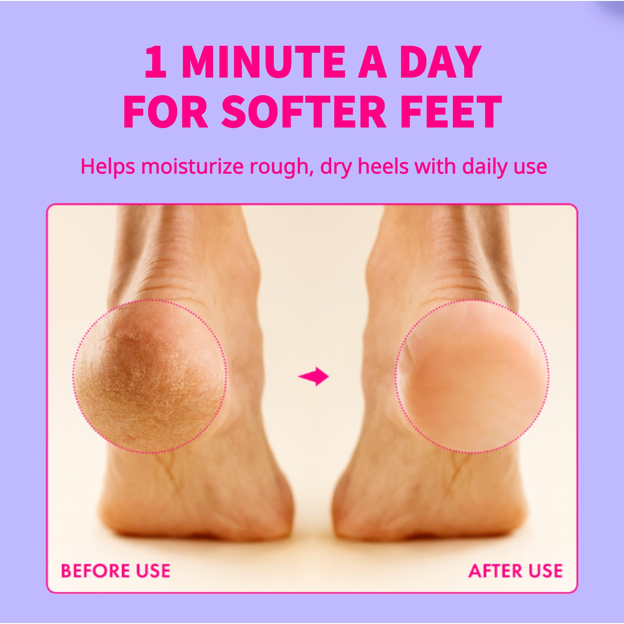 Loynu helps fresher shoes by reducing odor in sneakers and boots.