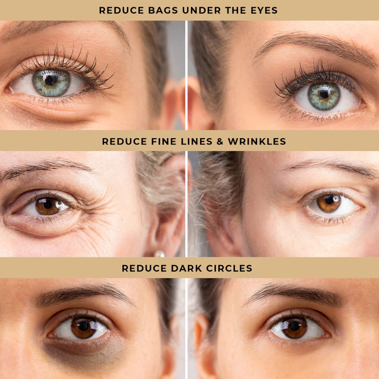 LPH LAB Under-eye bag reduction image highlights puffiness improvement potential