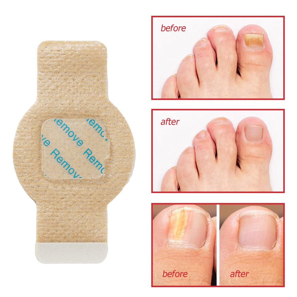 LTQXGT Extra-strength Nail Patches applied to mend cracks and strengthen nails