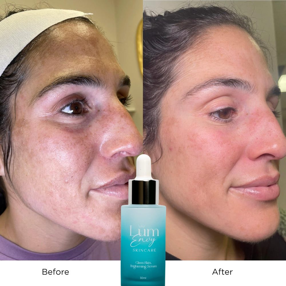 LumEnvy centella asiatica soothing plant extract reduces redness.