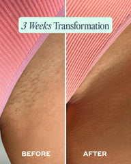 Luna Daily Mini Ingrown Hair Oil on skin closeup demonstrates quick-absorbing hydration