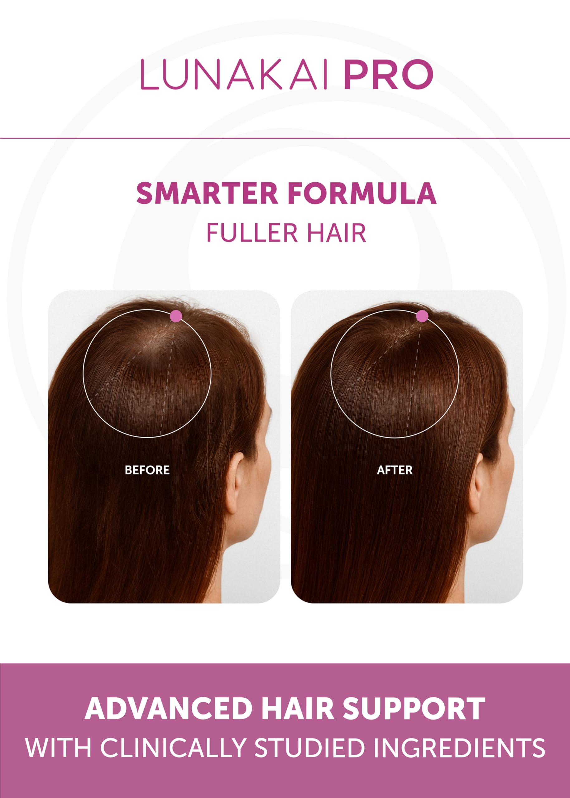 Lunakai Pro saw palmetto bottle visual emphasizes plant-based hair wellness.