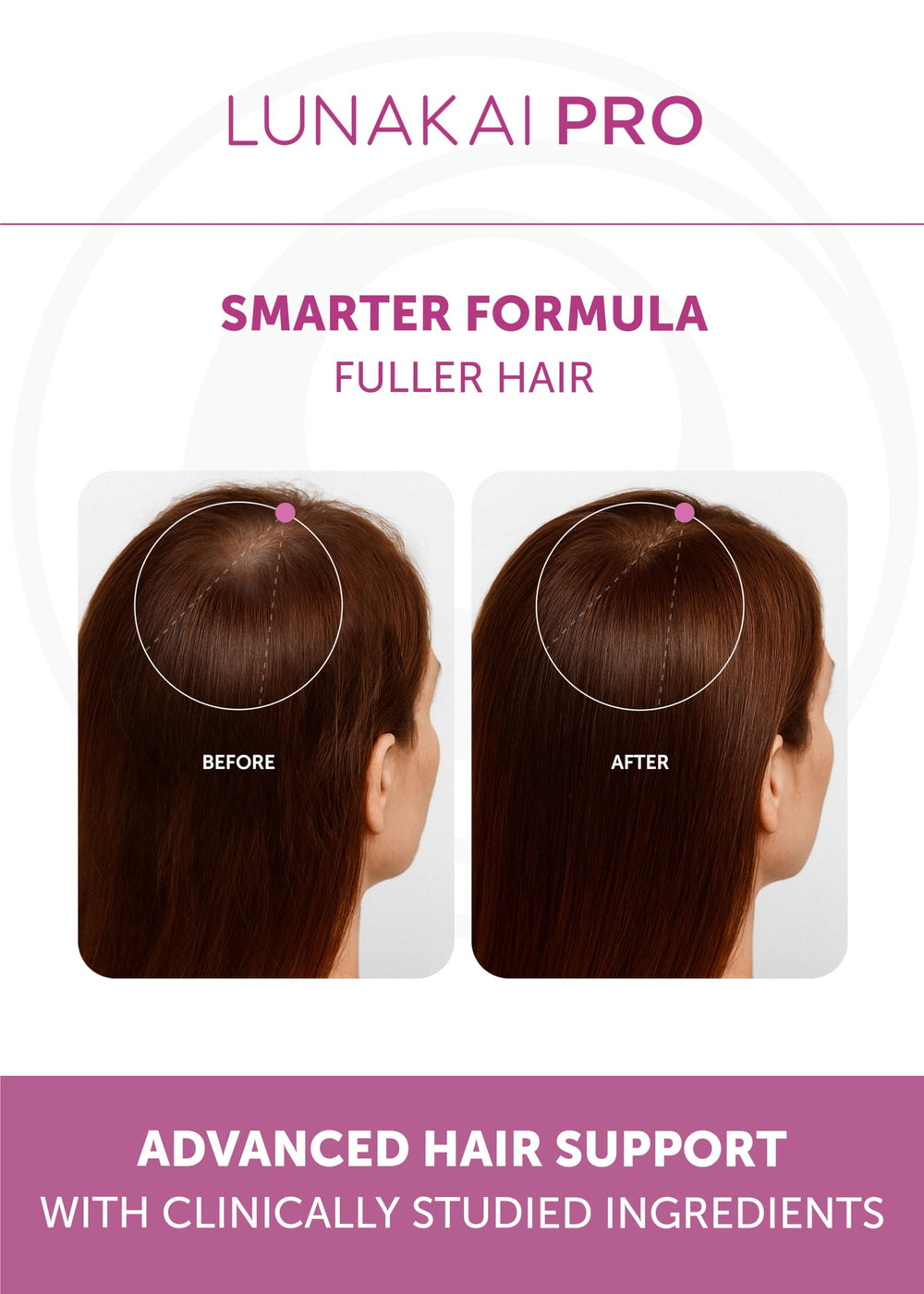 Lunakai Pro saw palmetto bottle visual emphasizes plant-based hair wellness.