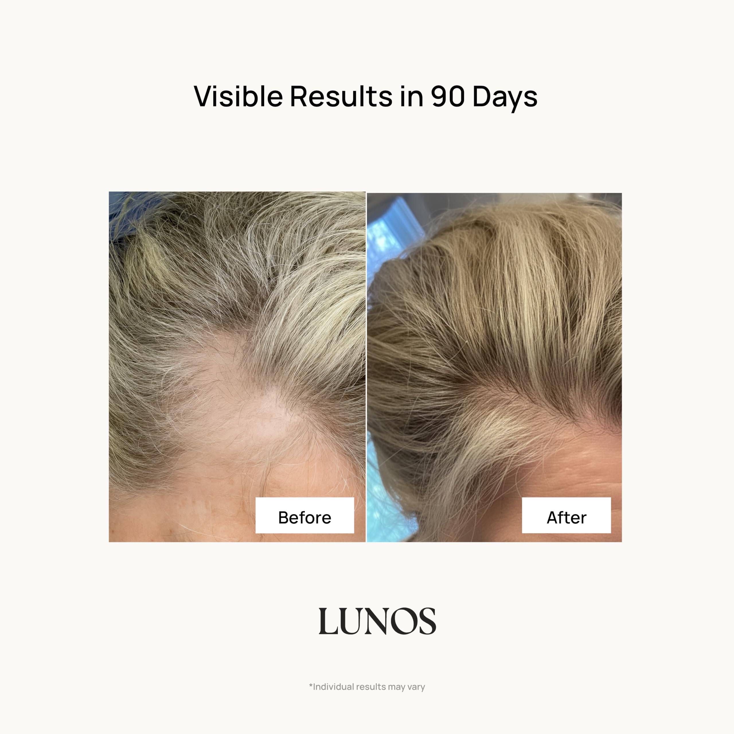 Lunos Grow Hair capsules packshot showing a convenient daily supplement.