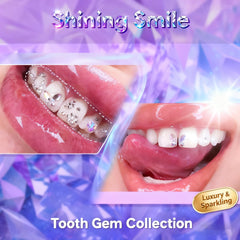 Luretrap shiny crystal gems create vibrant, eye-catching smiles