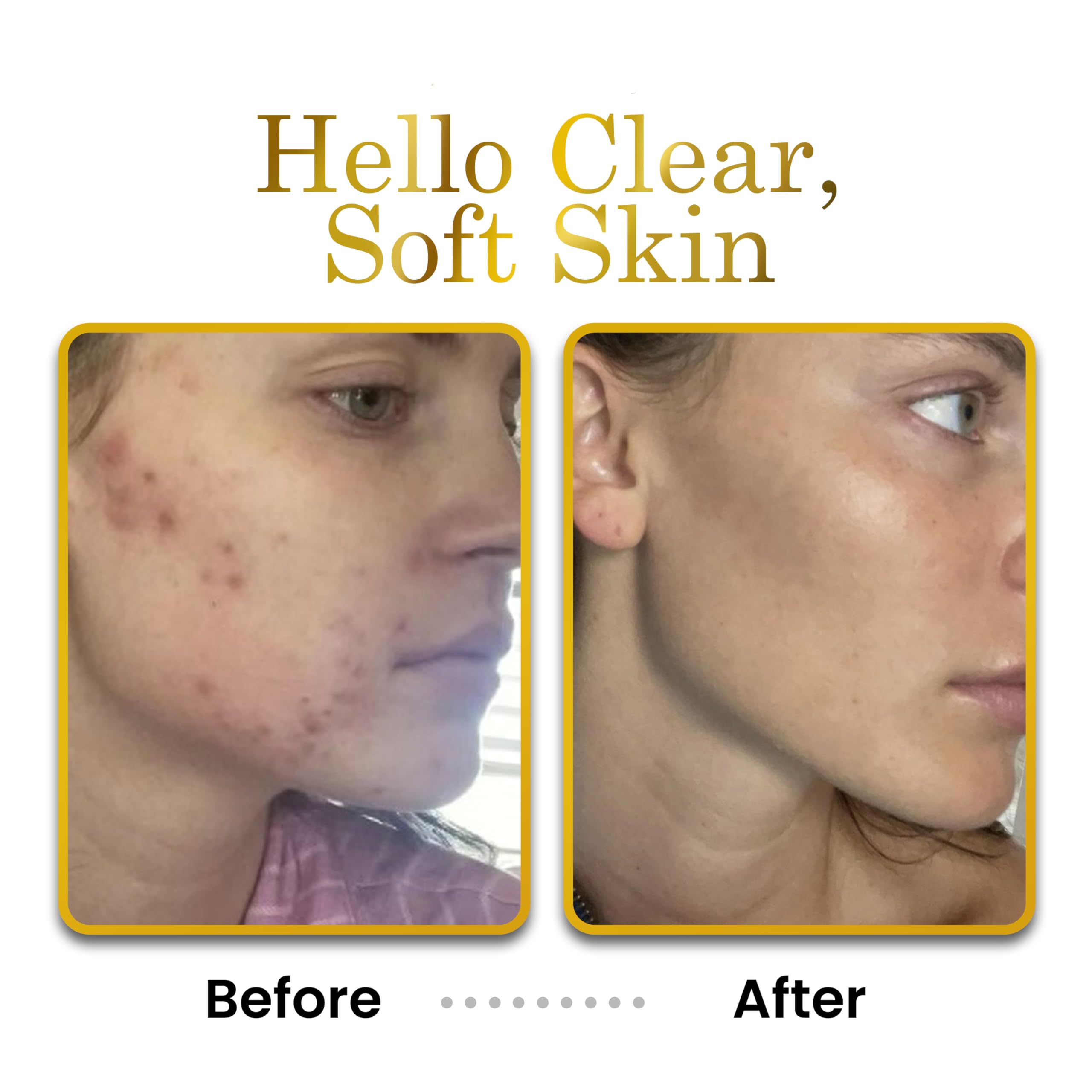 LUXEBEAUTY hyaluronic acid glow concept illustrating hydration boost.