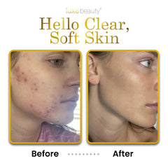 LUXEBEAUTY packaging panel notes sea buckthorn and vitamin B3 for skin vitality