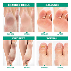 LV LAVINSO foot odor relief concept with a fresh feel