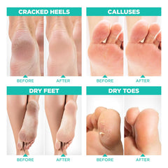 LV LAVINSO soft feet after treatment
