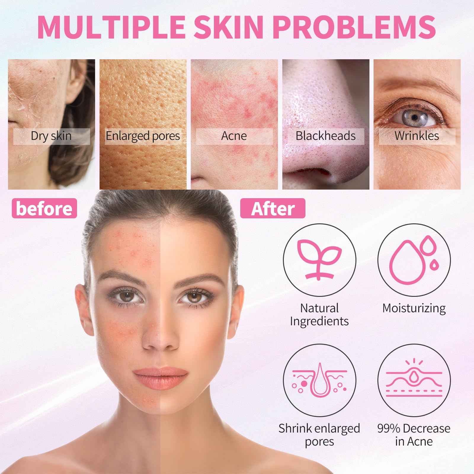 LXSKN Daily Acne Essentials Kit clay mask; absorbs impurities for radiant balance.