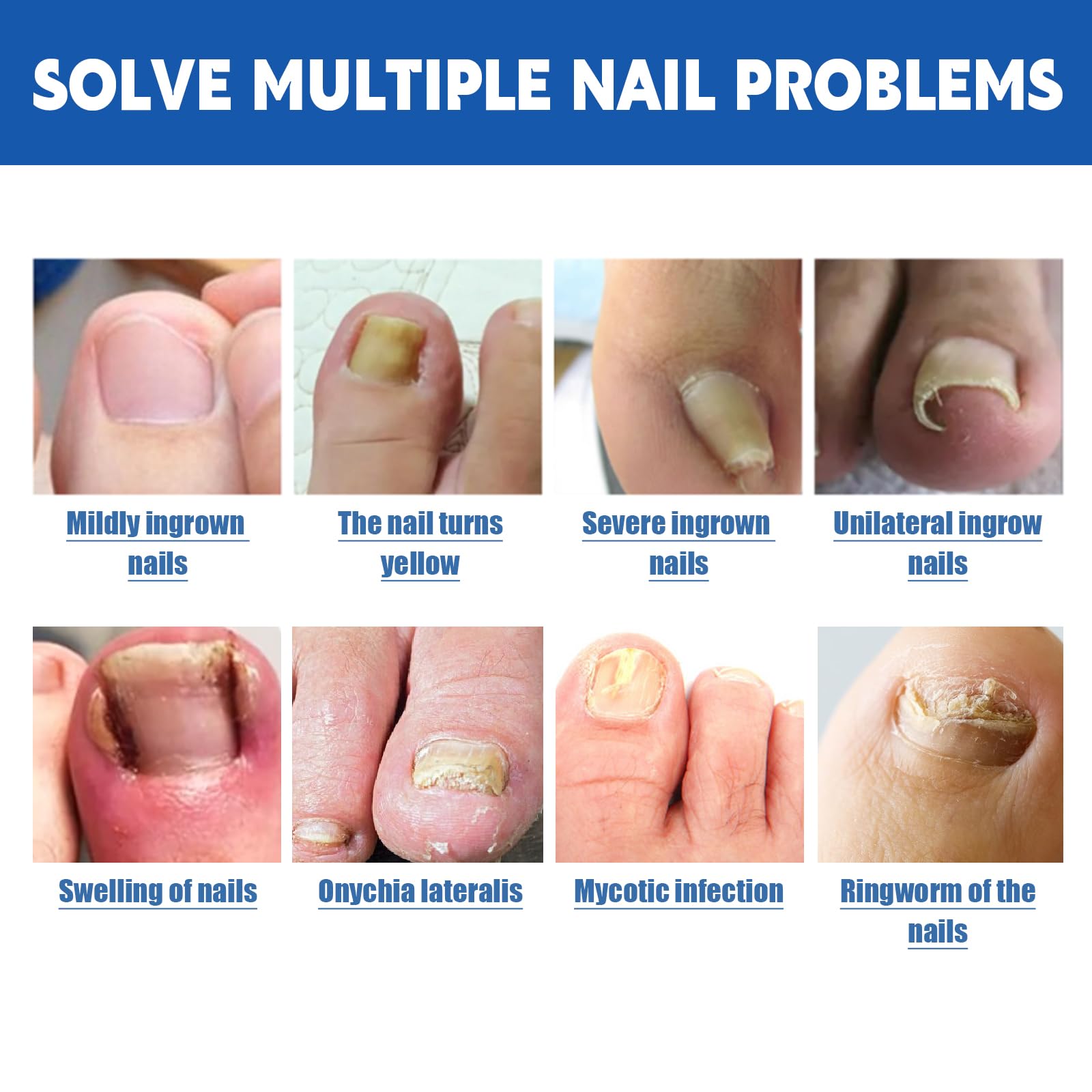 LYFXuGeMLM discreet toenail bandage protection under socks