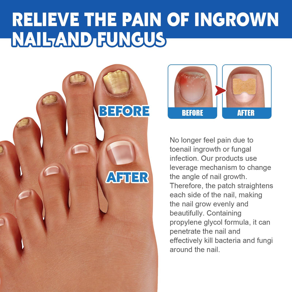 LYFXuGeMLM includes nail care bandages for restoration