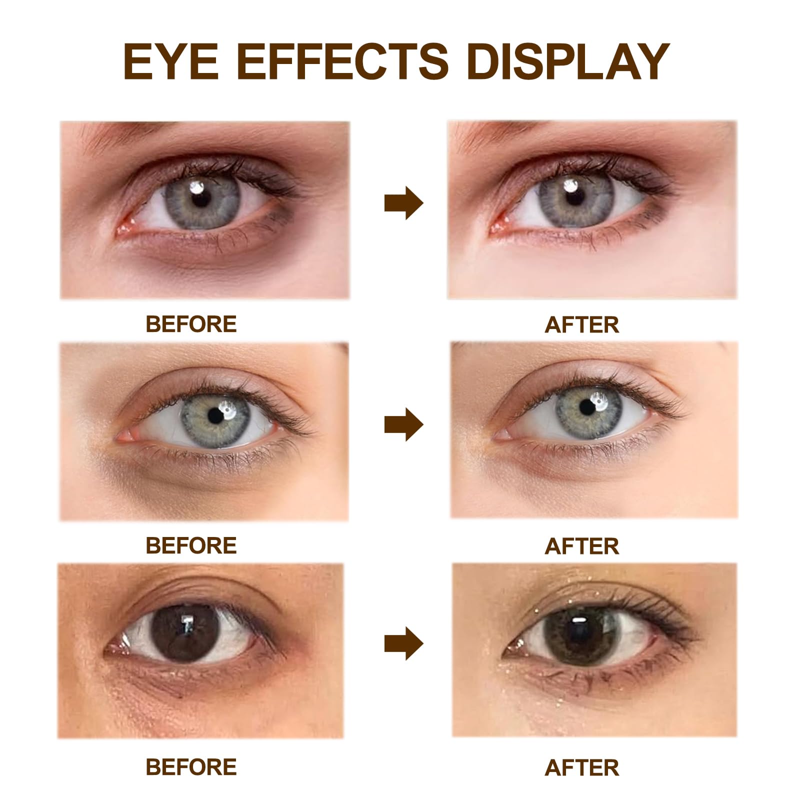lymznus caffeine eye cream provides anti-aging care for the eye area