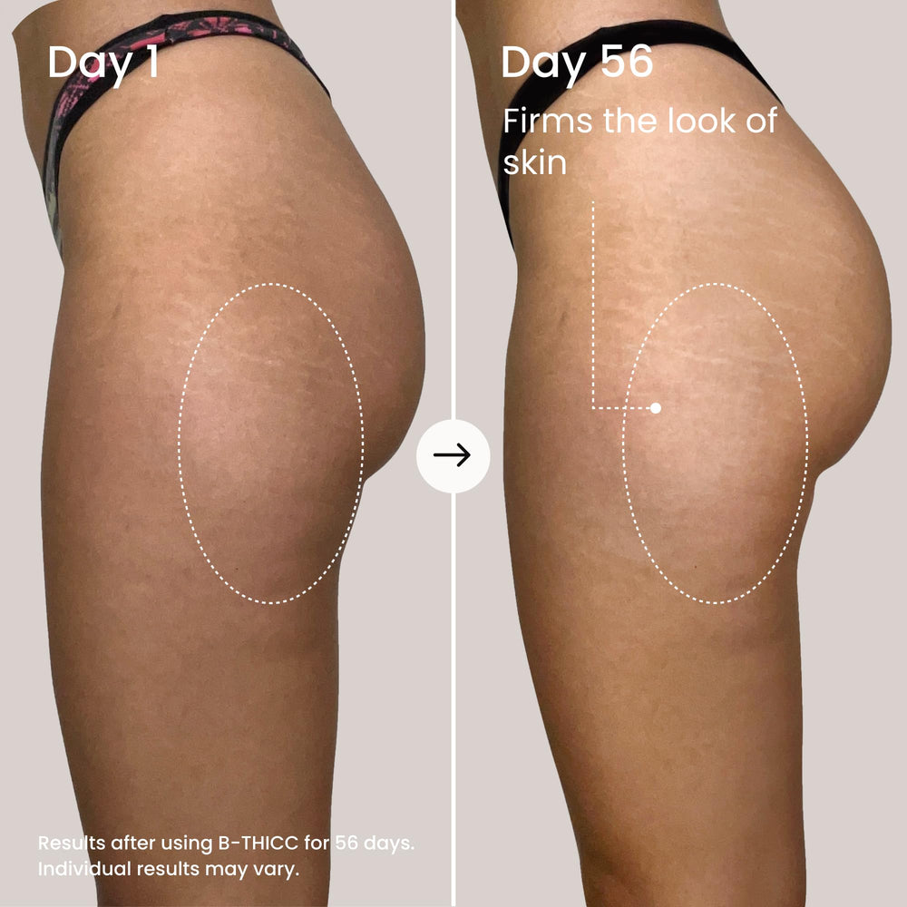 Hands applying the Maëlys B THICC cream to the booty area for daily use