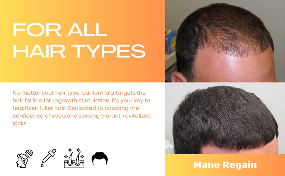 Mane Regain Extra Strength formula targets vertex thinning on scalp.