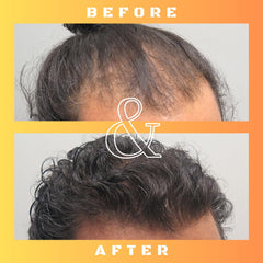 Mane Regain science backed formula shown in clean lab inspired packaging