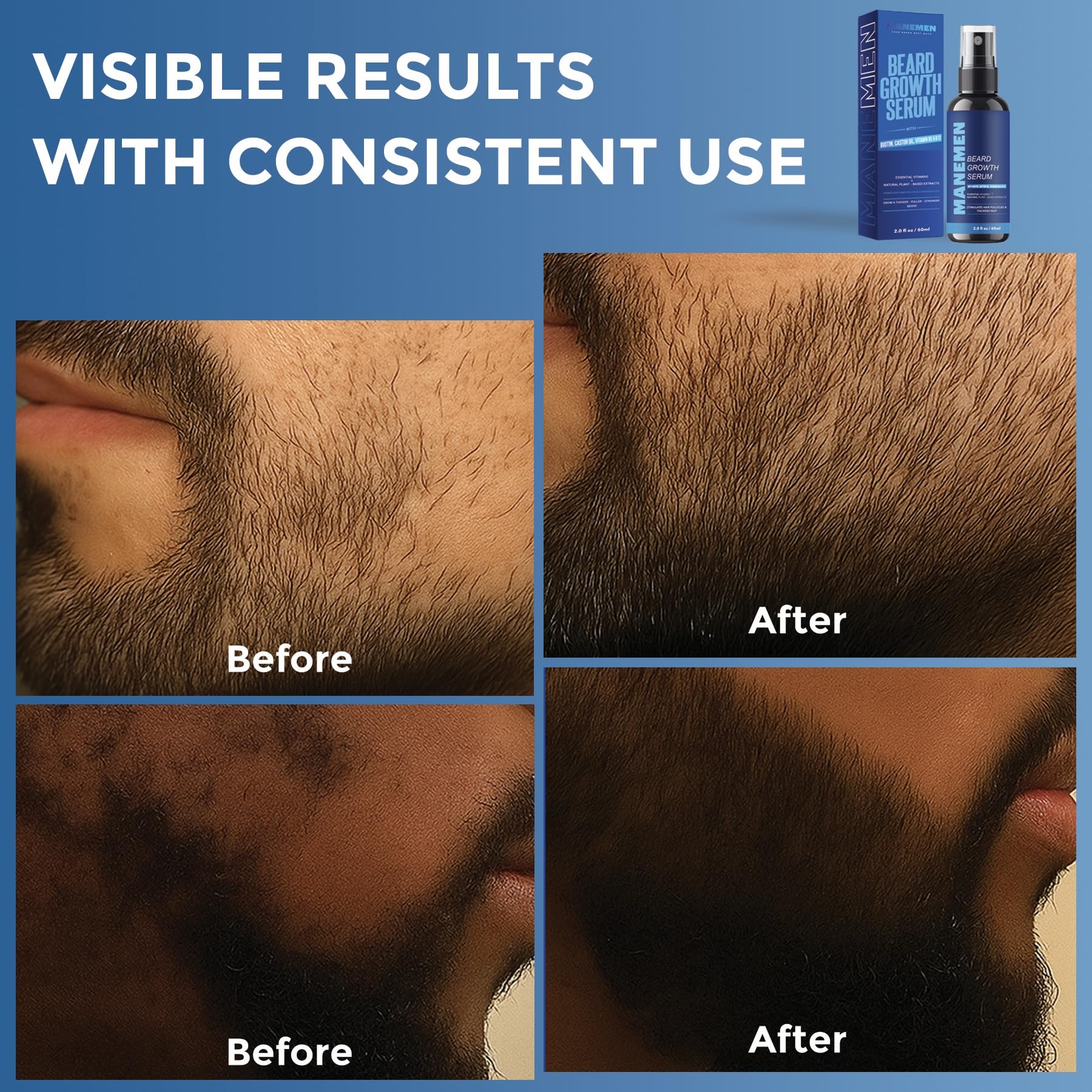MANEMEN serum natural extracts visual hints at rosemary and pumpkin seed benefits