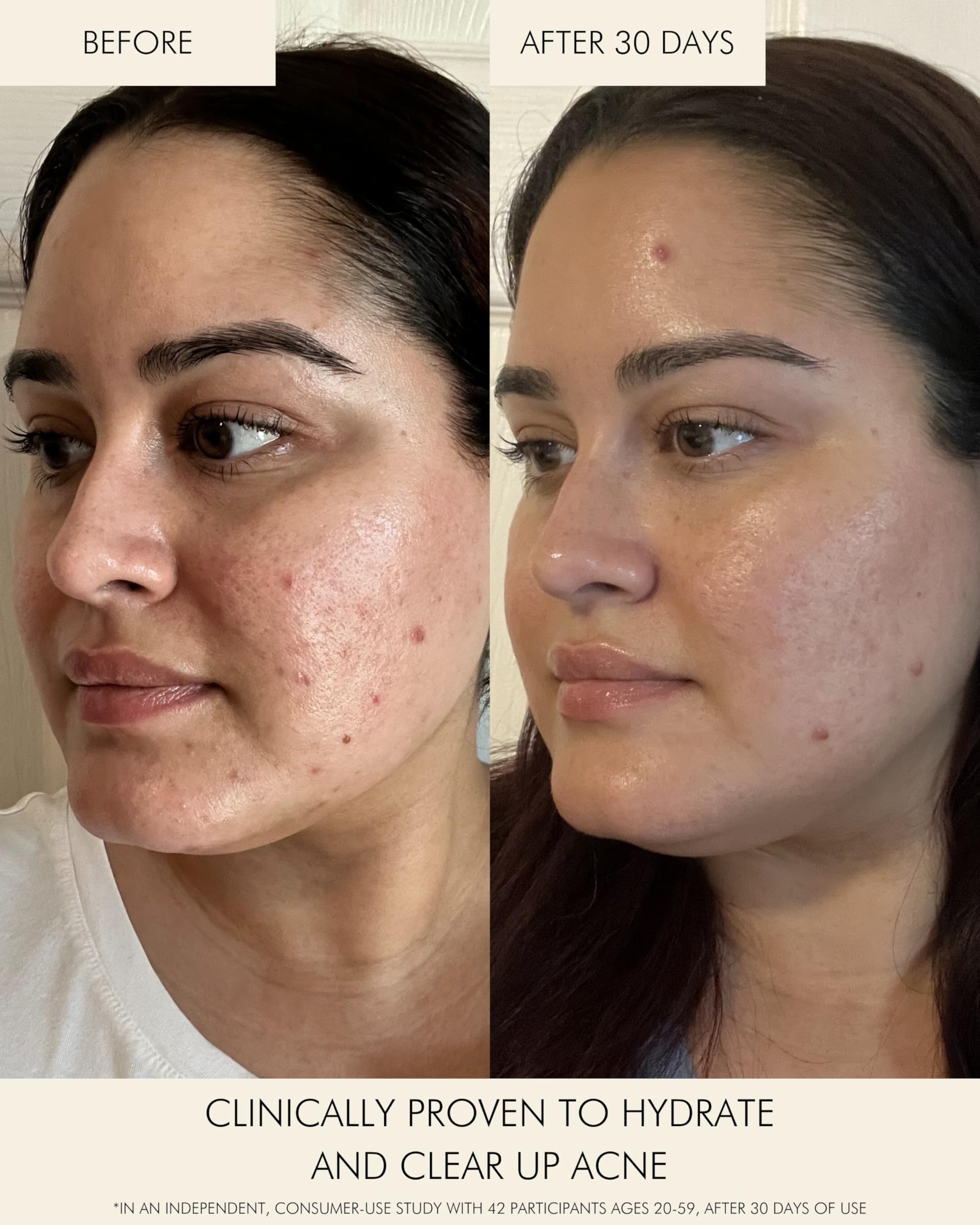 MARA All skin types may benefit from clarified pores and hydration.