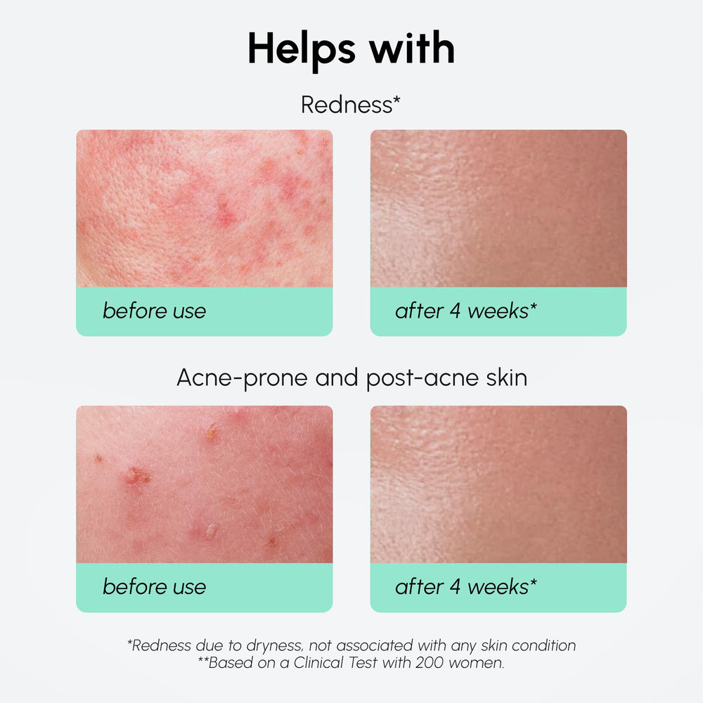 MAREE Azelaic Acid Serum on hand demonstrating lightweight hydration.